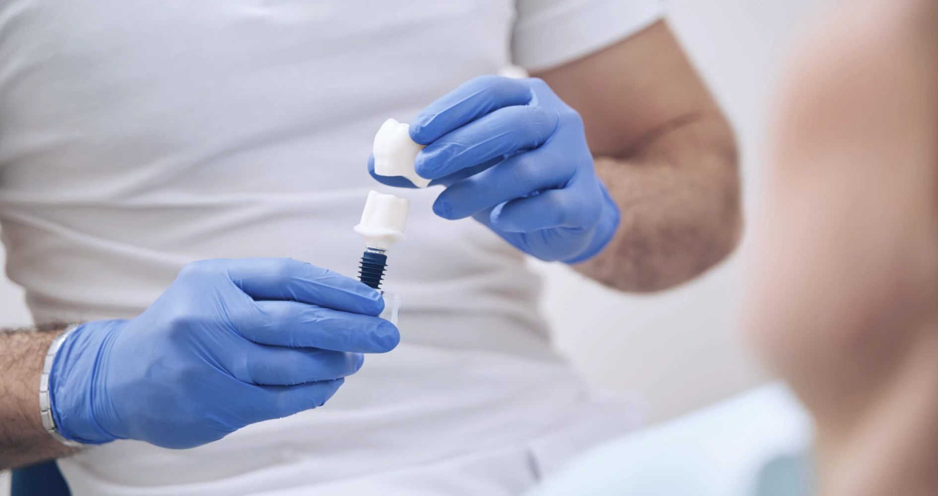 Implants dentaires  en zircone