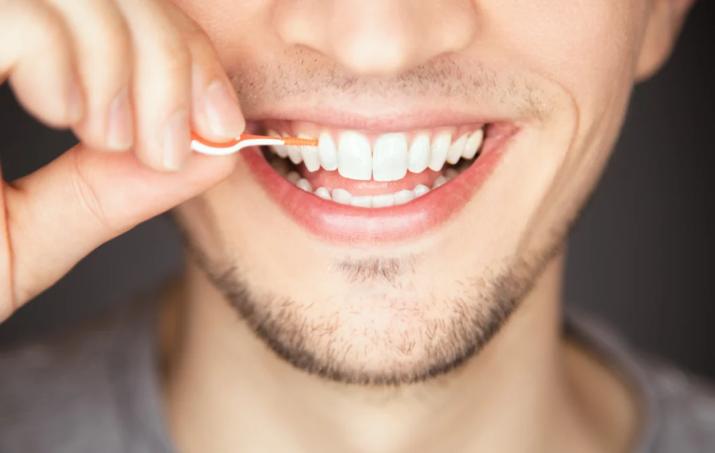 chirurgie guidee implantologie juan les pins chirurgie guidee implantologie juan les pins Utilisation des brossettes Chirurgiens-dentistes à Juan-les-pins | Cabinet dentaire du Lys