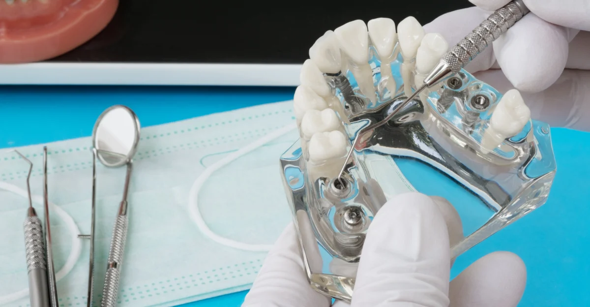 chirurgie dentaire guidee Chirurgie guidée Chirurgiens-dentistes à Juan-les-pins | Cabinet dentaire du Lys